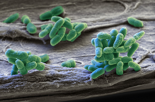 Cianobacterias o algas verdeazules (Cyanobacteria)