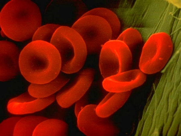 La hemoglobina