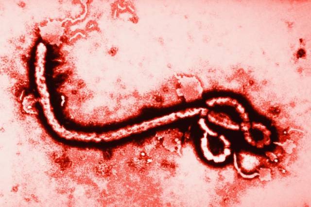 Qué hacer para prevenir el Ébola