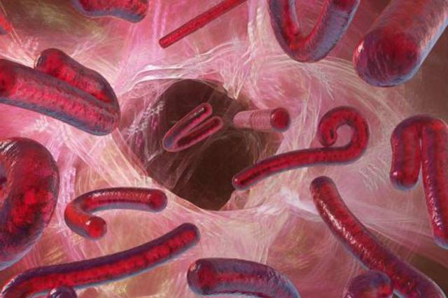 Síntomas del virus Ébola